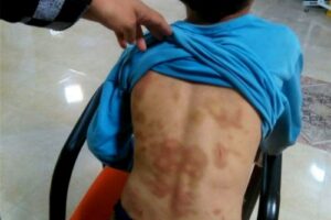 وقتی یک به اصطلاح معلم، زخم میزند؛ من معلم، در کجای این ماجرا ایستادهام؟